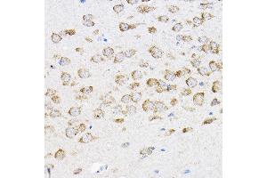 Immunohistochemistry of paraffin-embedded mouse brain using RPL4 Rabbit pAb (ABIN6129106, ABIN6147145, ABIN6147146 and ABIN6221591) at dilution of 1:100 (40x lens). (RPL4 Antikörper  (AA 1-240))