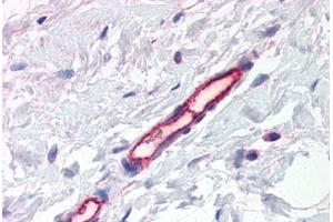 Human Breast, Vessels (formalin-fixed, paraffin-embedded) stained with PLXDC1 antibody ABIN337391 at 2. (PLXDC1 Antikörper  (AA 411-427))