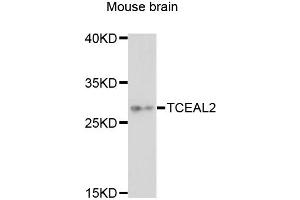 Western blot analysis of extracts of mouse brain, using TCEAL2 antibody (ABIN6293088) at 1:3000 dilution. (TCEAL2 Antikörper)