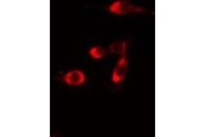 ABIN6275708 staining  Hela cells by IF/ICC. (RAD51C Antikörper  (Internal Region))