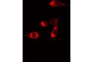 ABIN6275708 staining  Hela cells by IF/ICC.