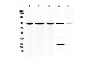 Western blot analysis of Complement C7 using anti-Complement C7 antibody . (C7 Antikörper  (AA 233-453))
