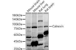 Western blot analysis of extracts of various cell lines, using Calnexin antibody (ABIN7266031) at 1:1000 dilution. (Calnexin Antikörper  (AA 501-592))