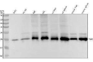 Western blot analysis of PSB9 using anti-PSB9 antibody (ABIN7606074).