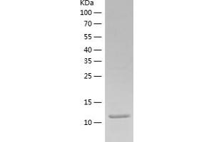 Western Blotting (WB) image for Chemokine (C-C Motif) Ligand 5 (CCL5) (AA 24-91) (Active) protein (His tag) (ABIN7122307)