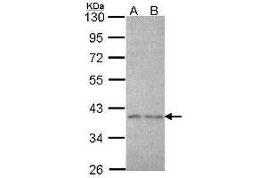 WB Image Sample (30 ug of whole cell lysate) A: A431 , B: H1299 10% SDS PAGE antibody diluted at 1:1000 (EIF3I Antikörper)