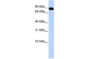 WB Suggested Anti-CREBL1 Antibody Titration: 0. (ATF6B Antikörper  (Middle Region))