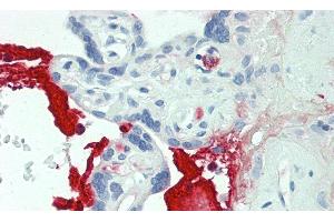 Immunohistochemistry (IHC) image for anti-Matrix Metallopeptidase 12 (Macrophage Elastase) (MMP12) (AA 100-286) antibody (ABIN7437821)