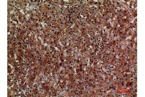 Immunohistochemistry (IHC) analysis of paraffin-embedded Human Liver, antibody was diluted at 1:100.