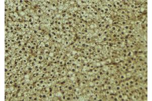 ABIN6273215 at 1/100 staining Mouse liver tissue by IHC-P. (CPS1 Antikörper)