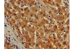 Immunohistochemistry of paraffin-embedded human liver tissue using ABIN7157050 at dilution of 1:100 (ISCA1 Antikörper  (AA 67-122))