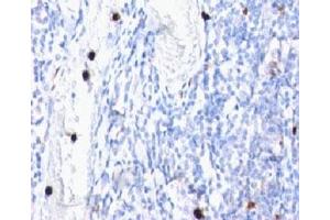 anti-Myeloid antibody