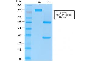 SDS-PAGE Analysis Purified CD86 Mouse Recombinant Monoclonal Antibody (rC86/1146). (Rekombinanter CD86 Antikörper)
