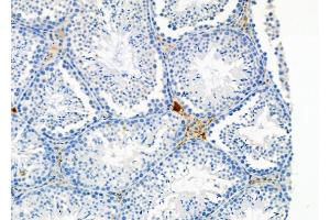 ABIN6264292 and ABIN6278946 at 1/100 staining Mouse testis tissue by IHC-P. (PLCH2 Antikörper  (N-Term))