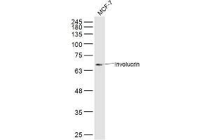 MCF7 lysates probed with Involucrin Polyclonal Antibody, Unconjugated  at 1:300 dilution and 4˚C overnight incubation. (Involucrin Antikörper  (AA 21-120))