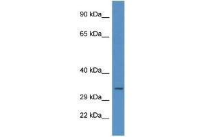 WB Suggested Anti-UNG AntibodyTitration: 1. (UNG Antikörper  (C-Term))