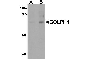Western blot analysis of GOLPH1 in K562 cell lysate with GOLPH1 antibody at (A) 1 and (B) 2 µg/mL. (ACBD3 Antikörper  (N-Term))
