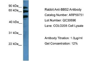 WB Suggested Anti-BBS2  Antibody Titration: 0. (BBS2 Antikörper  (Middle Region))