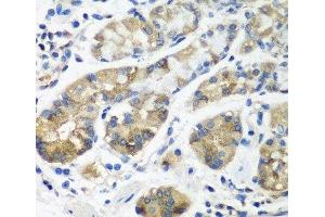 Immunohistochemistry of paraffin-embedded Human stomach using STX16 Polyclonal Antibody at dilution of 1:100 (40x lens). (Syntaxin 16 Antikörper)