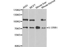 Western blot analysis of extracts of various cell lines, using IL12RB1 antibody. (IL12RB1 Antikörper)