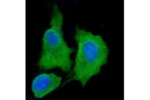 IF analysis of ALDH3A1 using anti-ALDH3A1 antibody (ABIN7601680). (ALDH3A1 Antikörper  (AA 413-453))