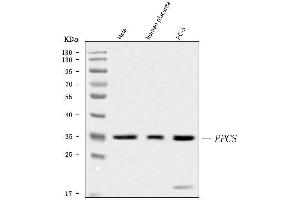 Western blot analysis of PPCS using anti-PPCS antibody (ABIN6719631).
