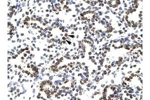 ZNF385 antibody was used for immunohistochemistry at a concentration of 4-8 ug/ml to stain Alveolar ceils (arrows) in Human Lung.