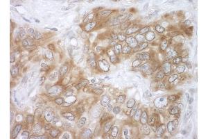 Immunohistochemistry (IHC) image for anti-VAMP (Vesicle-Associated Membrane Protein)-Associated Protein B and C (VAPB) (AA 100-150) antibody (ABIN7453809)