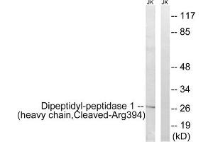 Western blot analysis of extracts from Jurkat cells, treated with etoposide (25uM, 1hour), using Dipeptidyl-peptidase 1 (heavy chain, Cleaved-Arg394) antibody. (CTSC Antikörper  (C-Term))
