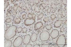 Immunoperoxidase of monoclonal antibody to HMGB1 on formalin-fixed paraffin-embedded human stomach. (HMGB1 Antikörper  (AA 1-215))