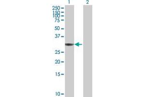 Western Blot analysis of ANXA4 expression in transfected 293T cell line by ANXA4 MaxPab polyclonal antibody. (Annexin IV Antikörper  (AA 1-321))