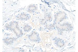 Immunohistochemistry (IHC) image for anti-Signal Transducer and Activator of Transcription 5B (STAT5B) (AA 737-787) antibody (ABIN7455110) (Rekombinanter STAT5B Antikörper  (AA 737-787))