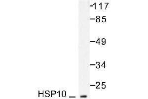 Image no. 1 for anti-Heat Shock 10kDa Protein 1 (Chaperonin 10) (HSPE1) antibody (ABIN265468) (HSPE1 Antikörper)