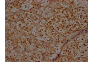 IHC image of ABIN7156399 diluted at 1:300 and staining in paraffin-embedded human adrenal gland tissue performed on a Leica BondTM system. (INTS1 Antikörper  (AA 51-342))