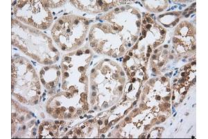 Image no. 9 for anti-Acetyl-CoA Acetyltransferase 2 (ACAT2) antibody (ABIN1496403) (ACAT2 Antikörper)