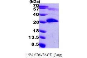 Pyridoxamine 5'-Phosphate Oxidase (PNPO) (AA 57-261) protein (His tag)