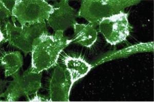 Immunofluorescent staining of A431 cells with anti-EGF Receptor antibody. (EGFR Antikörper  (AA 1020-1046))