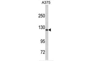 Western blot analysis of DSC1 Antibody (C-term) in A375 cell line lysates (35ug/lane). (Desmocollin 1 Antikörper  (C-Term))