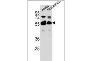 RGDS1 Antibody (Center) 1945c western blot analysis in HepG2,MDA-M cell line lysates (35 μg/lane). (RAP1GDS1 Antikörper  (AA 217-244))