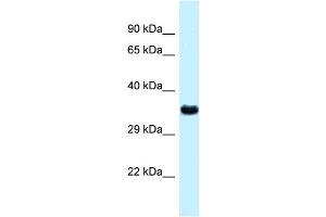 WB Suggested Anti-Ctsz Antibody   Titration: 1. (Cathepsin Z Antikörper  (N-Term))