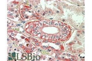Immunohistochemistry (IHC) image for anti-Flotillin 1 (FLOT1) (C-Term) antibody (ABIN184756)