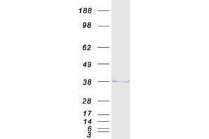 Western Blotting (WB) image for Exosome Component 7 (EXOSC7) (Transcript Variant 1) protein (Myc-DYKDDDDK Tag) (ABIN2720634)