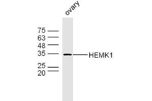 Mouse ovary lysates probed with HEMK1 Polyclonal Antibody, Unconjugated  at 1:300 dilution and 4˚C overnight incubation.