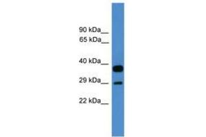Image no. 1 for anti-OTU Domain, Ubiquitin Aldehyde Binding 2 (OTUB2) (AA 91-140) antibody (ABIN6745385)