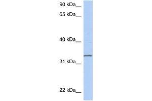 WB Suggested Anti-C3orf62 Antibody Titration: 0. (C3orf62 Antikörper  (Middle Region))