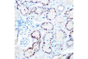 Immunohistochemistry of paraffin-embedded rat kidney using  Rabbit pAb (ABIN3015826, ABIN3015827, ABIN3015828 and ABIN6219178) at dilution of 1:100 (40x lens).