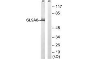 Western Blotting (WB) image for anti-Solute Carrier Family 9 (Sodium/hydrogen Exchanger), Member 8 (SLC9A8) (AA 451-500) antibody (ABIN2890644) (NHE8 Antikörper  (AA 451-500))