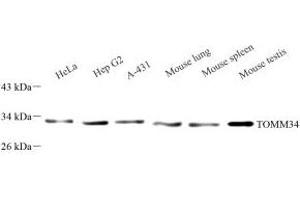 Western blot analysis of TOMM34 (ABIN7075984) at dilution of 1: 1000 (TOMM34 Antikörper)