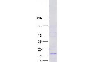 Western Blotting (WB) image for Myosin, Light Chain 12B, Regulatory (MYL12B) (Transcript Variant 4) protein (Myc-DYKDDDDK Tag) (ABIN2726714)