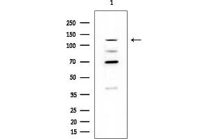 anti-Endosome/Lysosome-associated Apoptosis and Autophagy Regulator 1 (ELAPOR1) antibody